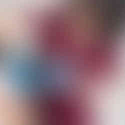 Acupuncturist placing acupuncture needles in the neck area to relieve tension headaches.