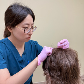 Licensed acupuncturist Michelle She placing acupuncture needles on a patient’s head during treatment for stress and migraines.