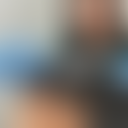 Licensed acupuncturist Erica Wang placing acupuncture needles on a patient’s head during treatment for chronic headache relief