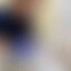 Acupuncturist using e-stim therapy with acupuncture needles to and improve blood flow and relieve tension.