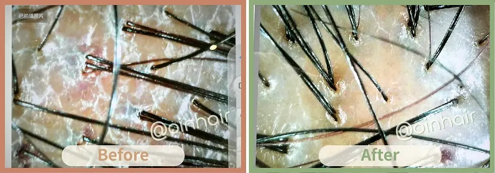 Close-up images compare a scalp before and after treatment. Left is dry with few strands, right shows improved density. Labels: Before, After.