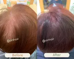 OiN Hair 中藥理療天然染髮前後對比