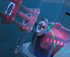 radiotherapy-1.jpg