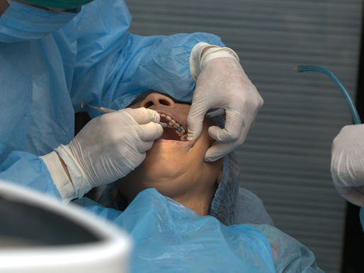 tooth extraction