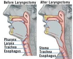 Schulman Blitz, LLP Settles Medical Malpractice Wrongful Death Case For $1.95 Million