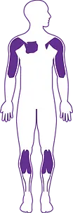 EDMD Image.webp