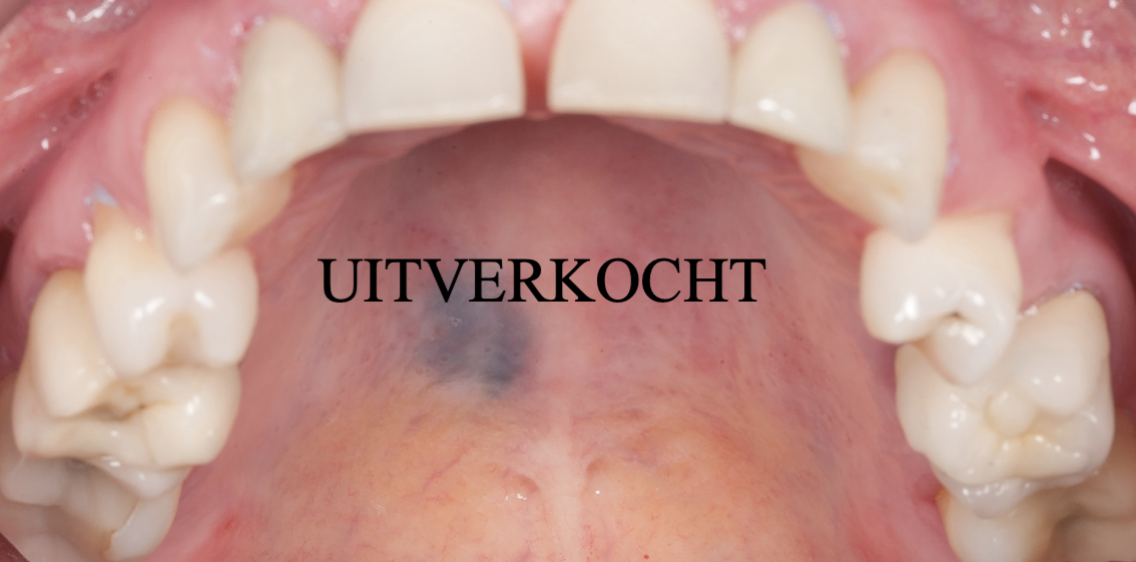Mond - en Kaakziekten voor tandartsen 2020 - Almere - Uitverkocht