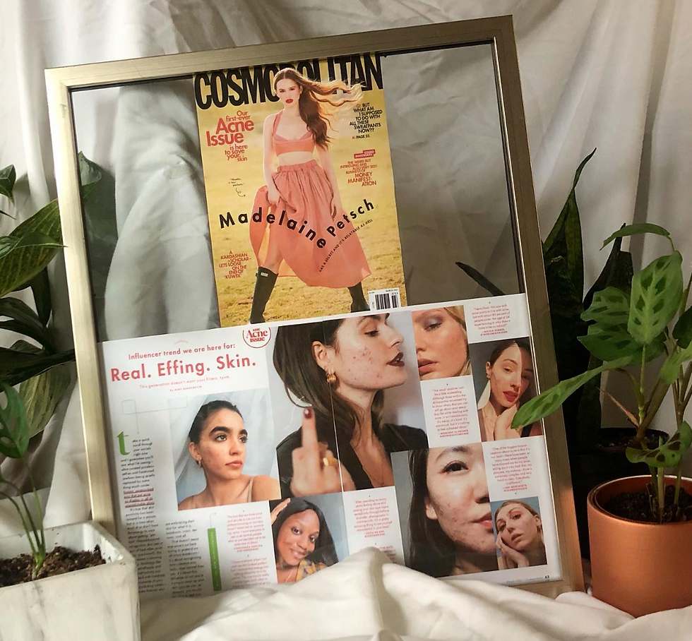 skinpositivity