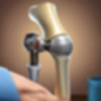 Total Knee Replacement at sharvari hospital