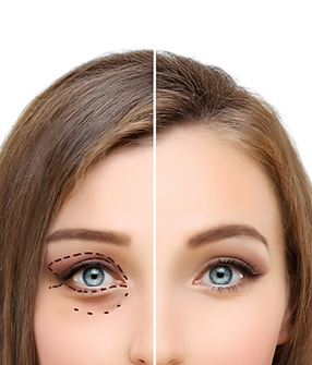 Dr Raul Posts (8)_edited_edited.png