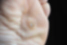 Dun Laoghaire Foot Clinic