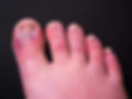 Dun Laoghaire Foot Clinic