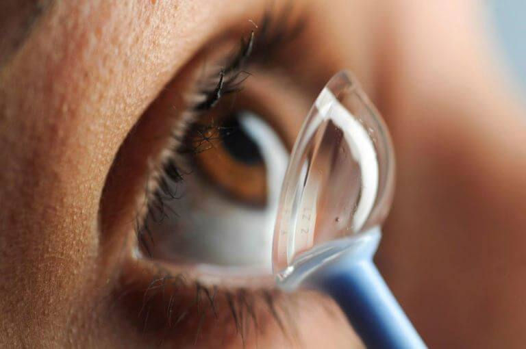 Treating Dry Eye Disease with a scleral contact lens