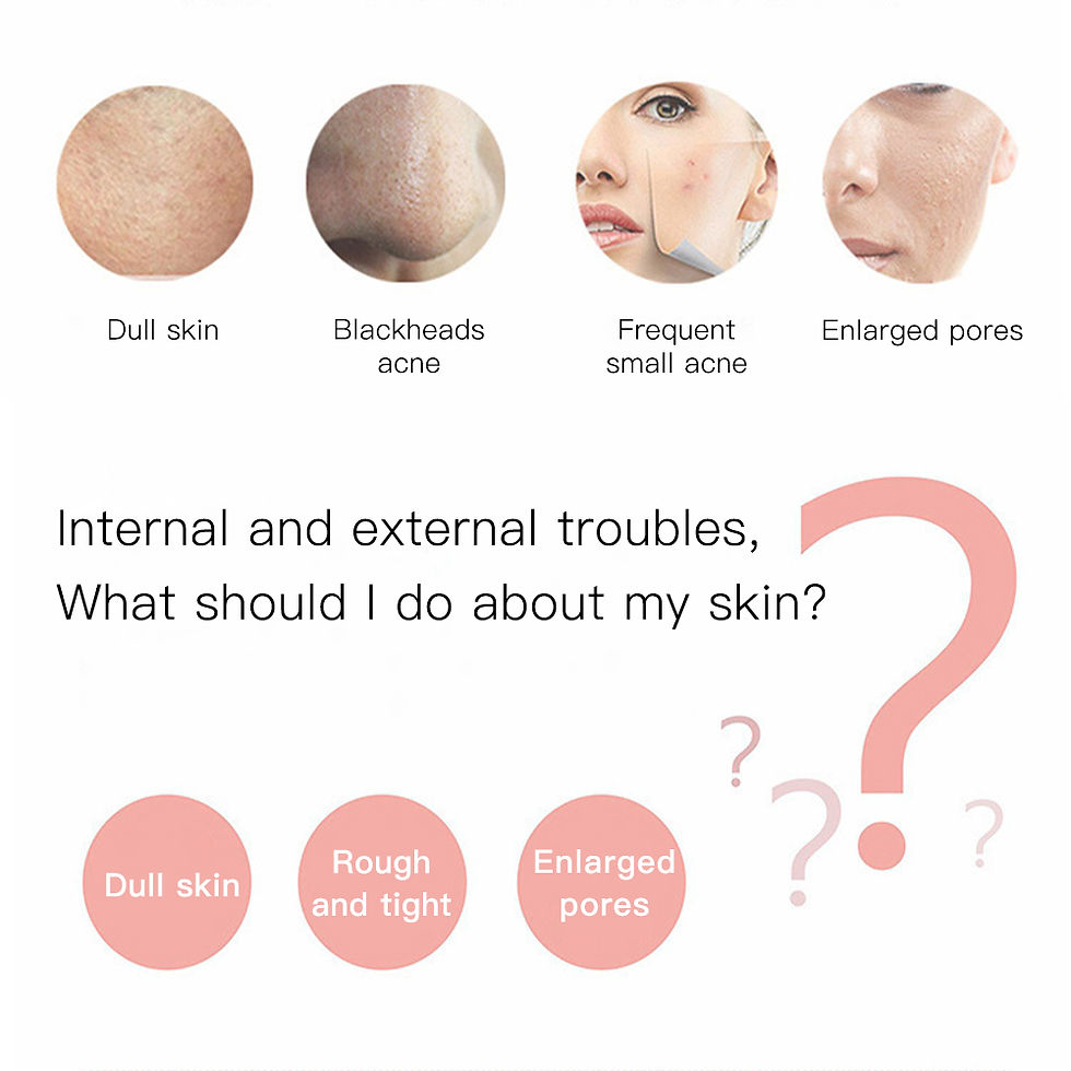 Thumbnail: Bloom Ultrasonic Skin Scrubber – Deep Pore Cleansing Device