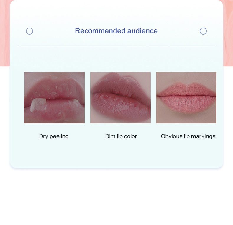 Thumbnail: Bloom Honey Lip Balm Collection