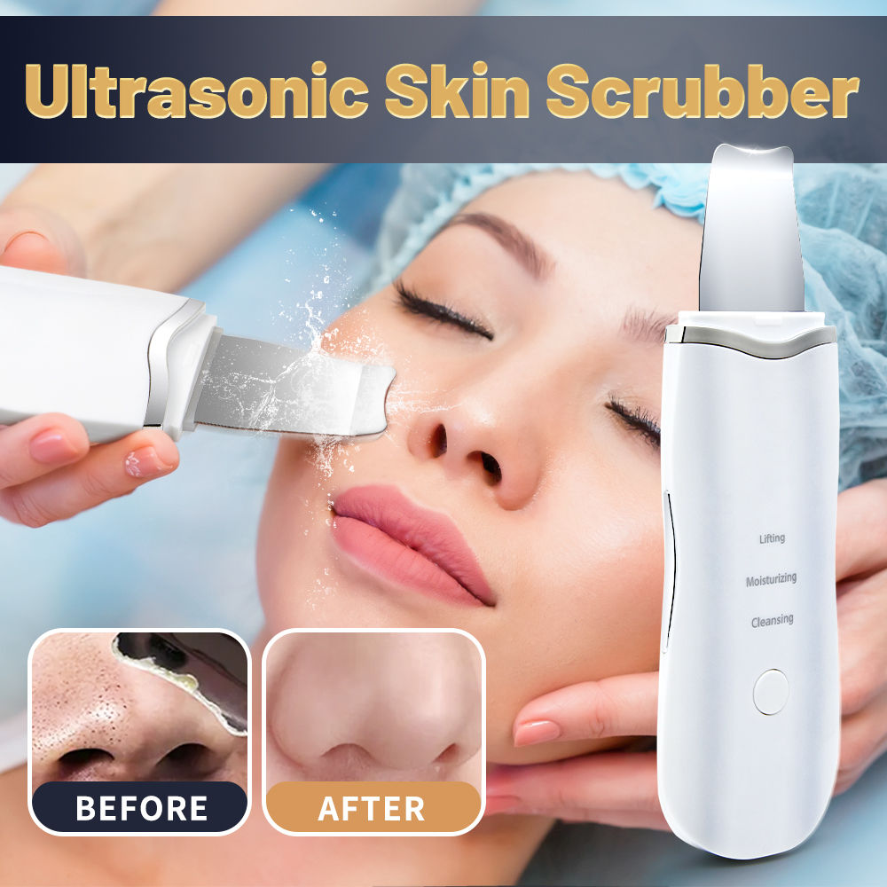Bloom Ultrasonic Skin Scrubber – Deep Pore Cleansing Device