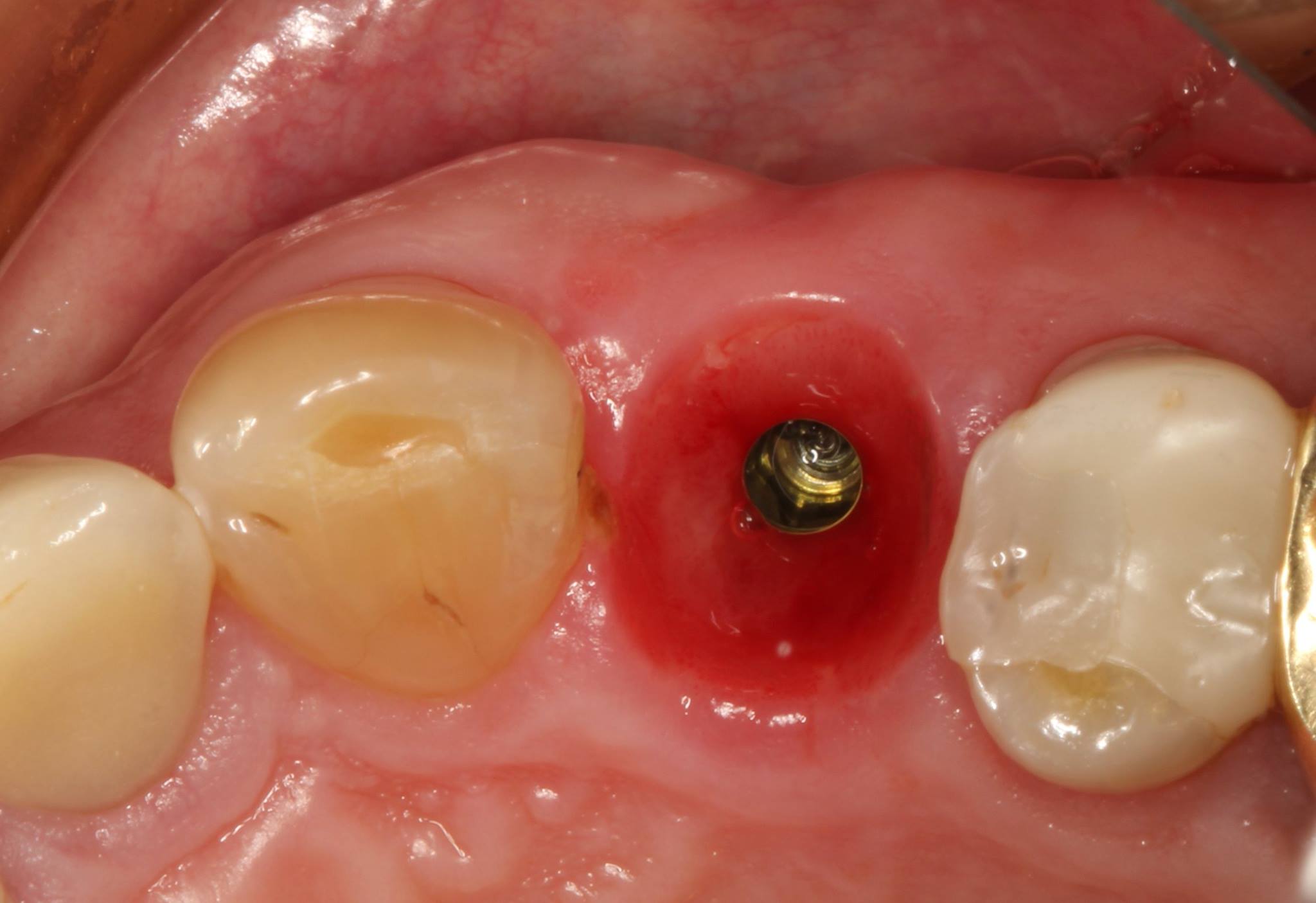 Ideal Emergence Profile