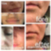 thumbnail 10.jpeg