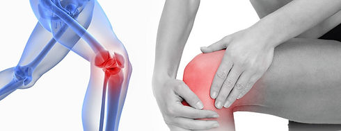 knee pain big.jpeg