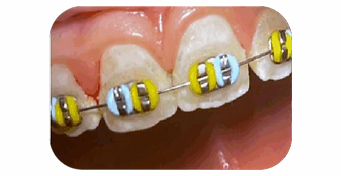 thumbnail_vVardis-Website-BeforeAfter-86