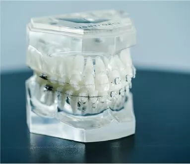 lightforce-teeth.webp