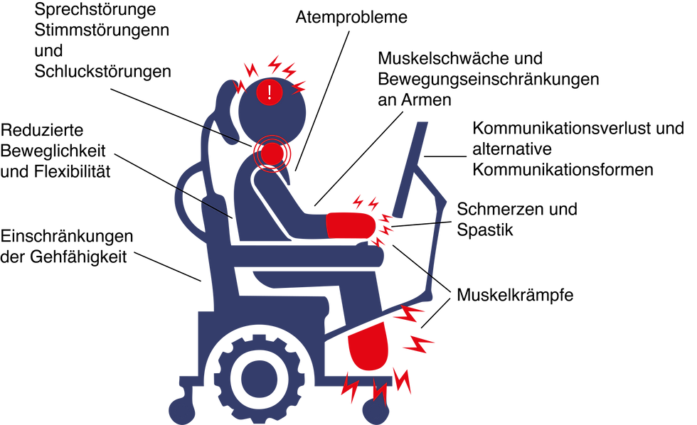 ALS.png