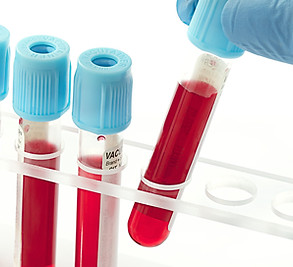 Examenes de laboratorio