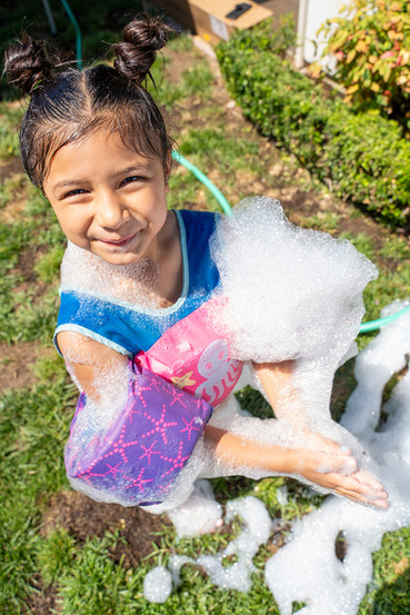 child burn survivor at camp