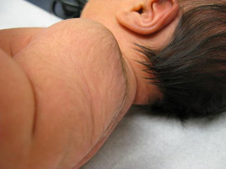 What is Terminal Length?