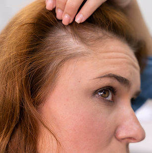 hair-loss_woman.jpg
