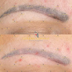 Saline removal.jpg