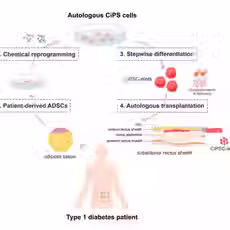 All about Islet Cell