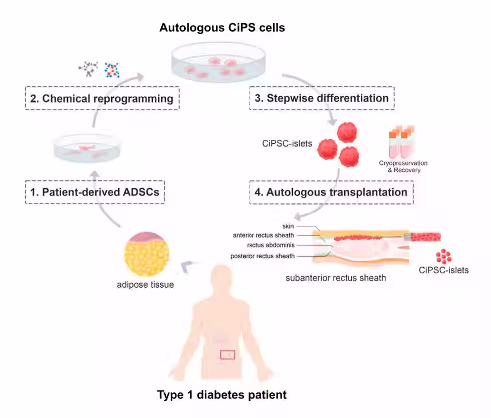 All about Islet Cell