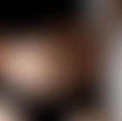 Why Preparing for Plastic Surgery With MLD Is Essential for Better Results