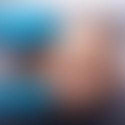 Why You’re Still Swollen Weeks After Lipo (Normal vs. Not Normal) — And How HealthSpa4u Can Help You Heal