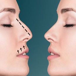 The Benefits of Manual Lymphatic Drainage After Rhinoplasty You Need to Know