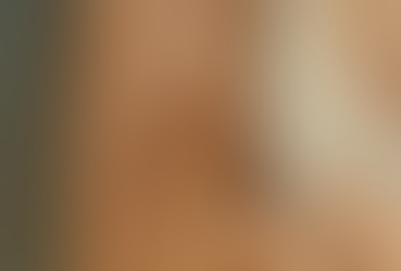 Queimadas em Formosa-GO aumentam internações e geram alertas de saúde pública