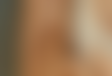 Queimadas em Formosa-GO aumentam internações e geram alertas de saúde pública