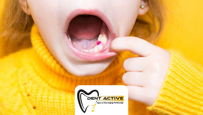 Milk Tooth Filling