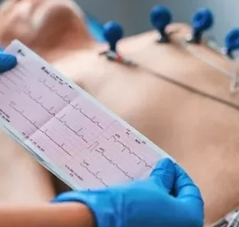 Eletrocardiograma - ECG.png