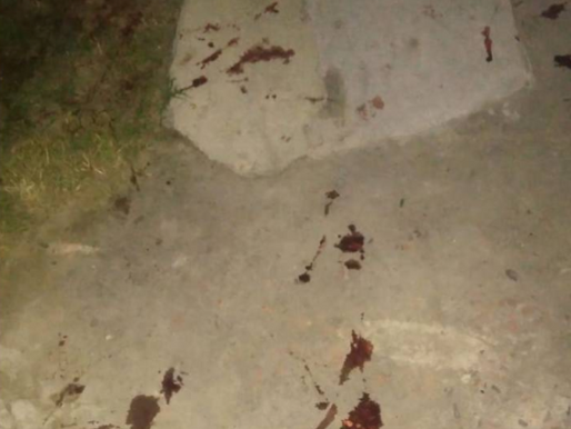 Homem é atingido com disparos de arma de fogo no bairro Formoso