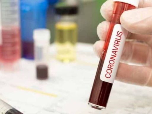 Dois casos de covid 19 são confirmados em Cruzeiro do Sul