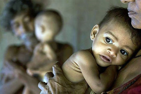 Malnutrition.jpg