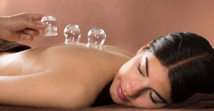 Client undergoing cupping therapy