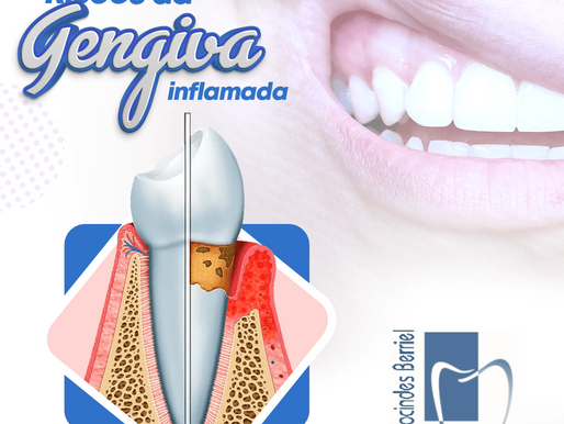 Riscos da Gengiva Inflamada