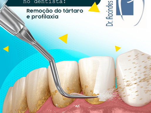 Profilaxia e Polimento dos Dentes