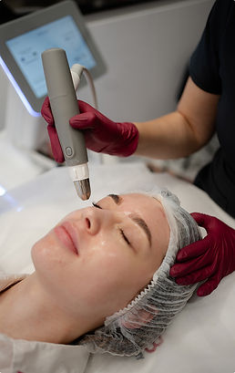 Проведення безін’єкційної мезотерапії Dermadrop TDA для обличчя