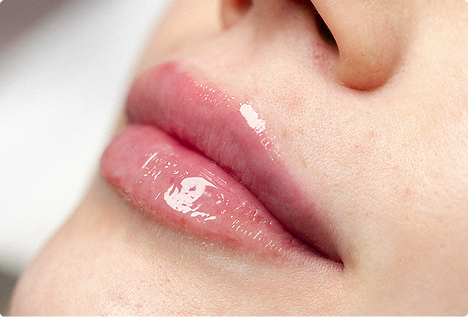 Контурна пластика губ у клініці Lips Boutique у Львові
