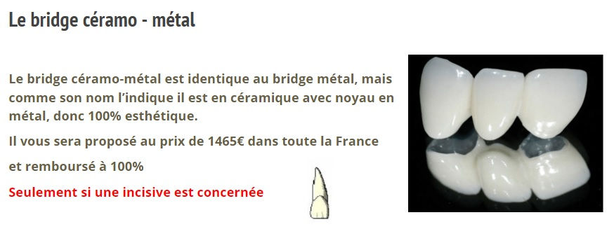 Copyright Prothese dentaire marseille 13 dentaire saint just dentiste 13013