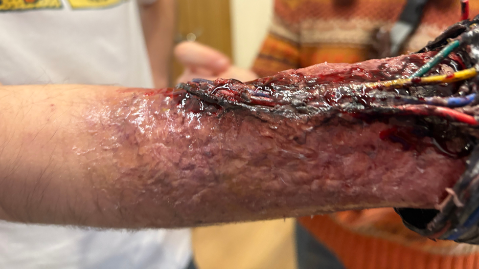 Hand prosthetics
